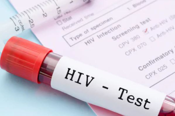 Como Funciona O Teste De Hiv E Biocenter