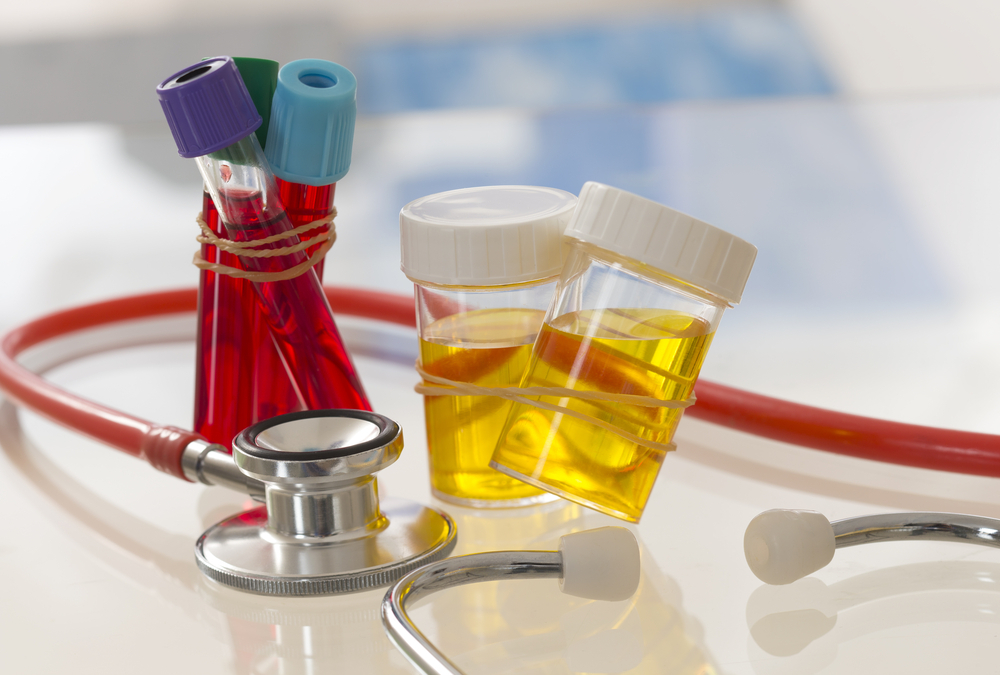 Cortisol entenda como funciona o exame Biocenter