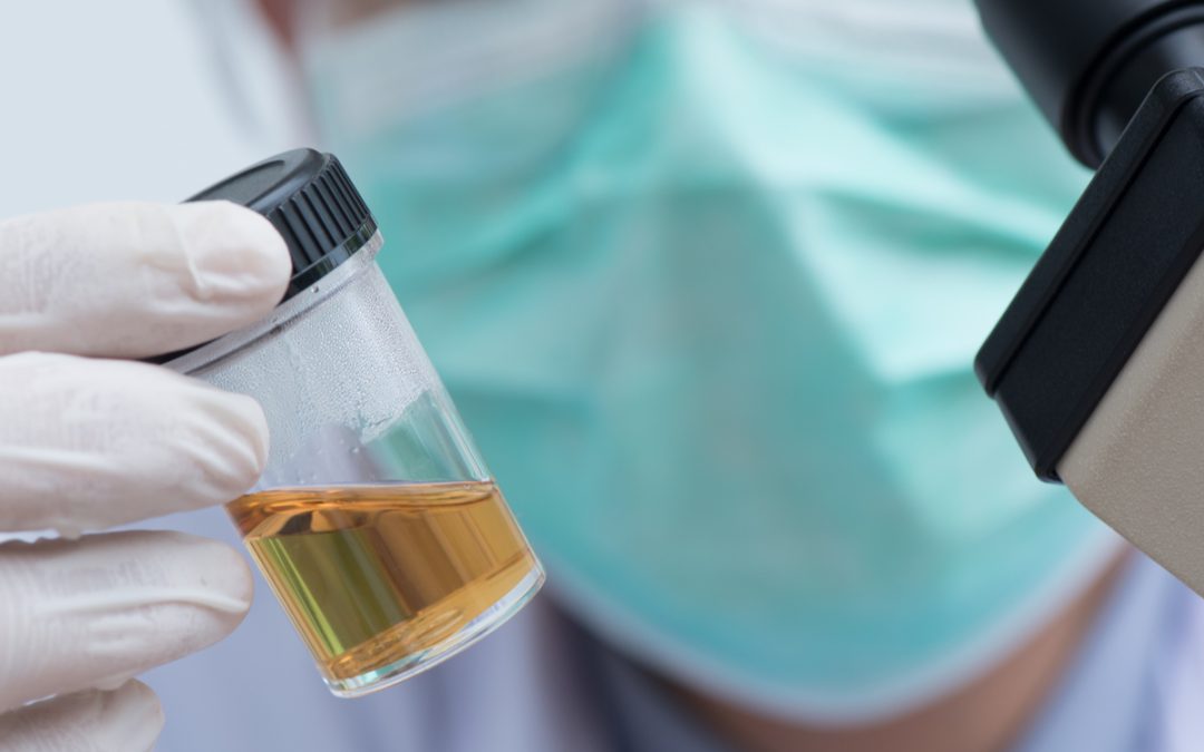 Você sabe a real importância do exame de urina?